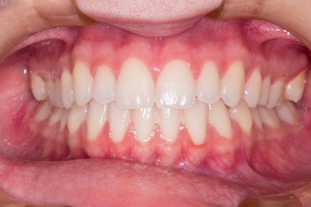 Teeth Smile Dentist Dentist - alexandreest / Pixabay
